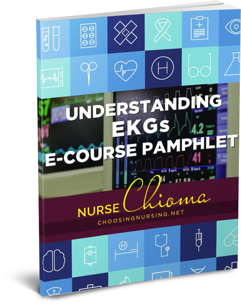 Understanding EKGs Guide