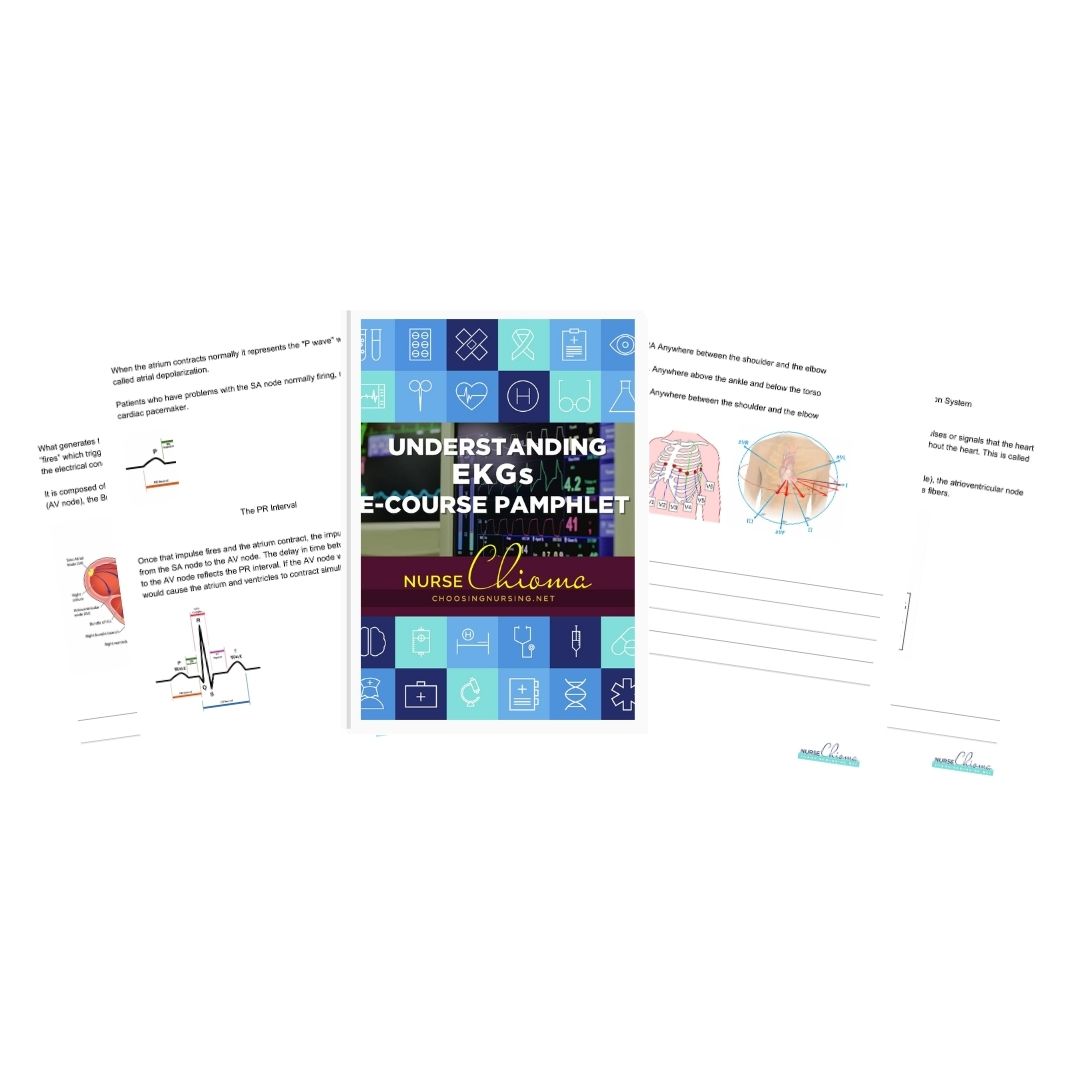 Understanding EKGs Guide- Ebook