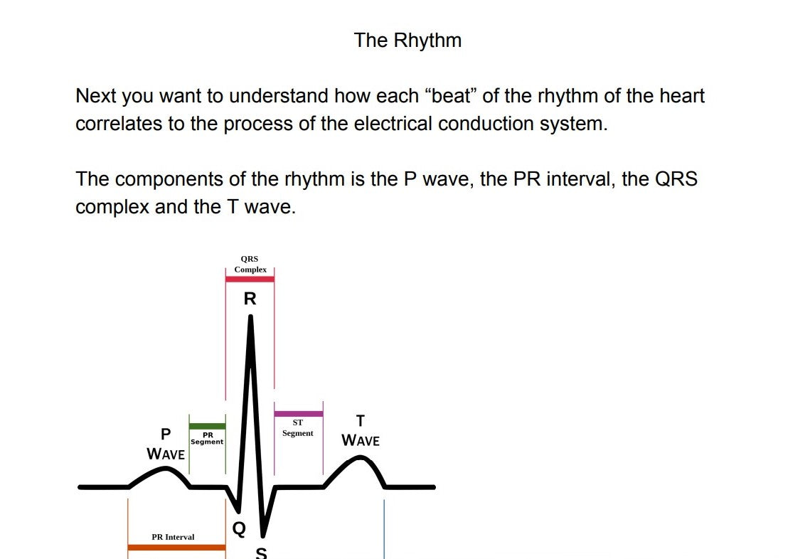 Understanding EKGs Guide- Ebook